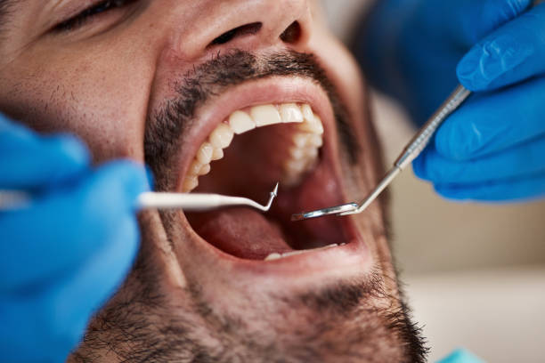 Best Emergency Dentist Near Me  in Kelly Ridge, CA