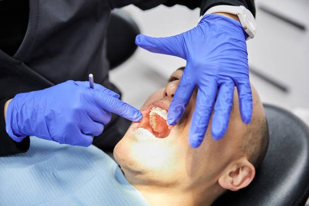 Best Chipped Tooth Repair Near Me  in Kelly Ridge, CA